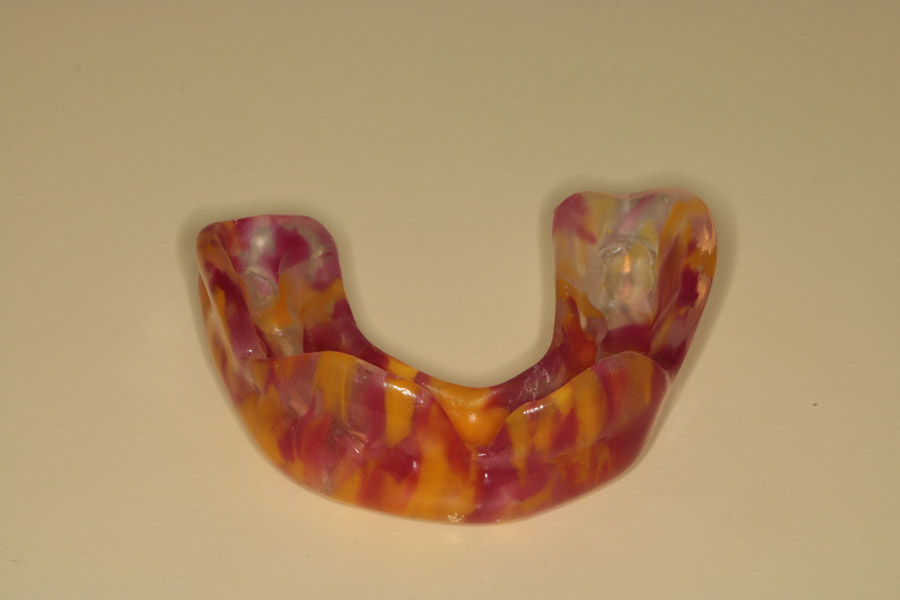 Professional dental mouthguards